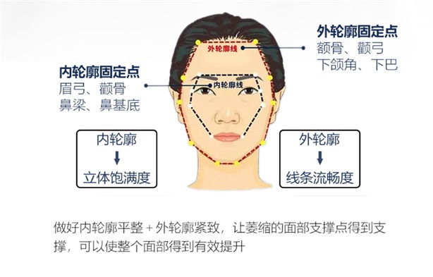 輪廓固定